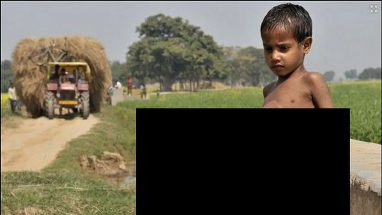 Absolut socant! S-a născut cu patru picioare si trei mâini, iar lumea il credea un MONSTRU!