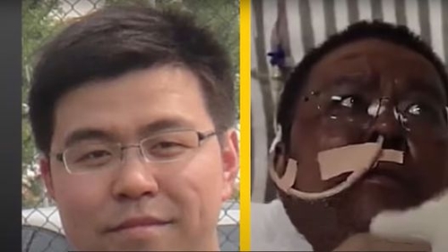 Infectat cu coronavirus, Hu Weifeng s-a stins din viață! Recent, s-a trezit cu pielea închisă la culoare și…