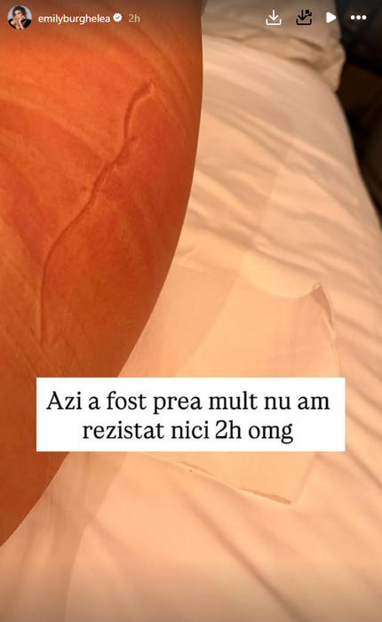 Cum arată abdomenul lui Emily Burghelea, după cea de-a treia naștere: „Trebuie să port ‘gipsul’ 5 zile consecutiv”