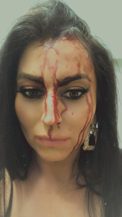Prezentatoarea TV a ajuns plină de sânge la spital. Imagini cu puternic impact emoțional