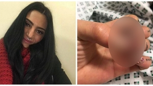 Unghiile cu acril o vor costa tot degetul! Ce a patit aceasta mamica dupa ce a fost la manichiura. Medicii nu s-au uitat la ea