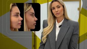 Oana Monea spune adevărul despre operațiile estetice care au scandalizat internetul: "Nu mi-am ridicat fața!"