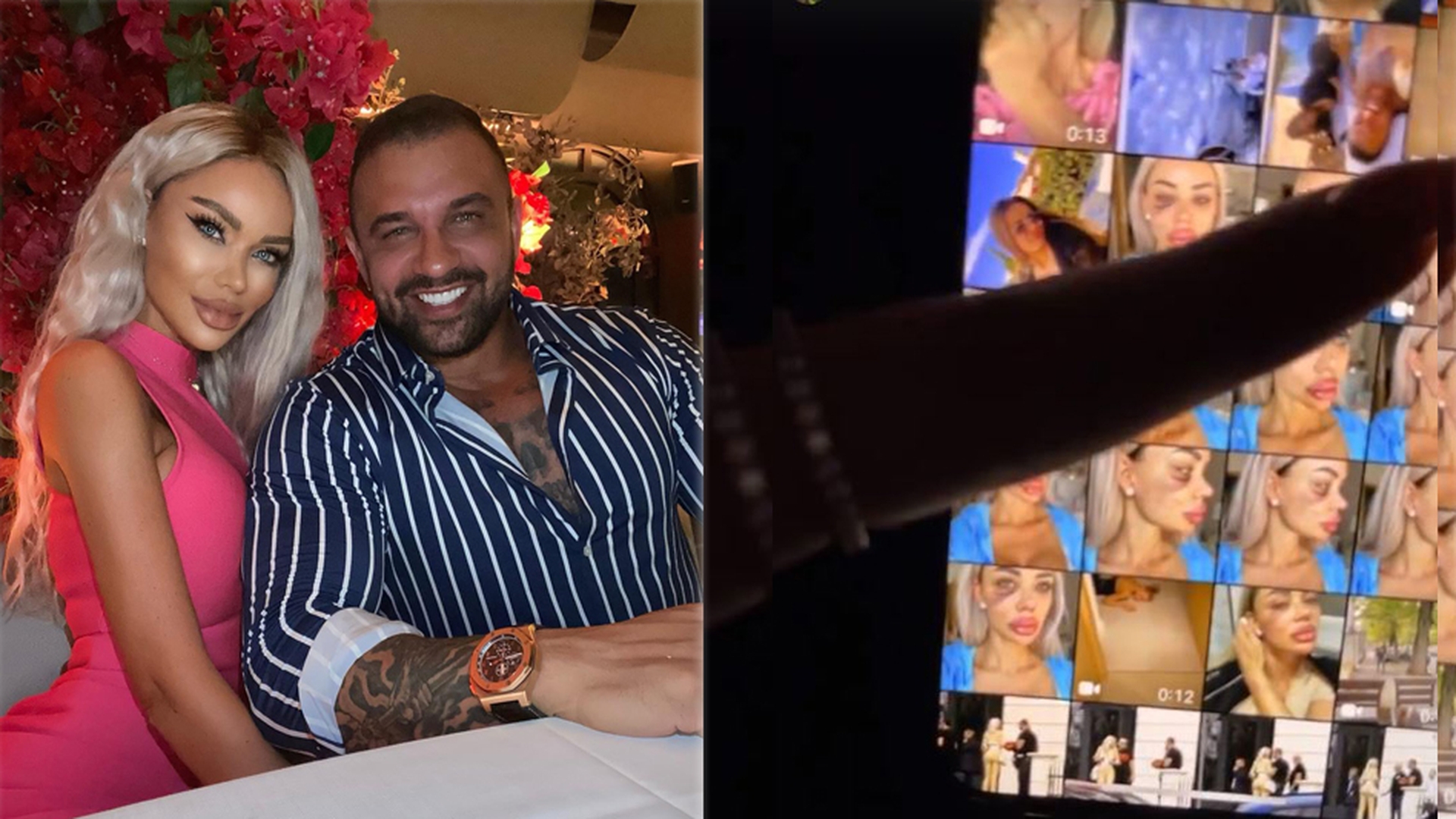 Bianca Drăgușanu a publicat mai multe imagini după ce a fost snopită de Alex Bodi: “Pentru pozele în care apar bătută, am depus o plângere penală” | FOTO