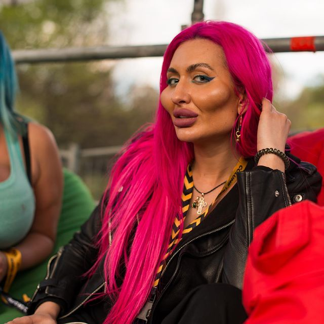 Cum a ajuns să arate o femeie dependentă de botox! Doctorii i-au spus să se oprească