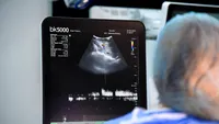 Recoltare complet laparoscopică, pentru un nou transplant hepatic  realizat cu succes la SANADOR