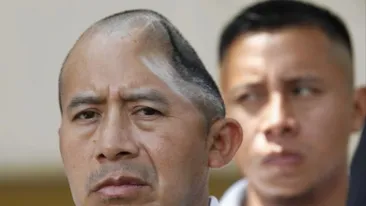 A rămas cu o gaură in cap după o bătaie cruntă! Craniul lui e ca o plăcintă. Cum arată bărbatul care nu iese din casa fara sapca