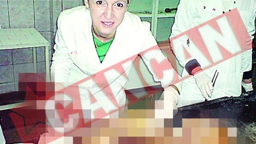 Povestea fetei care s-a pozat cu un mort in putrefactie