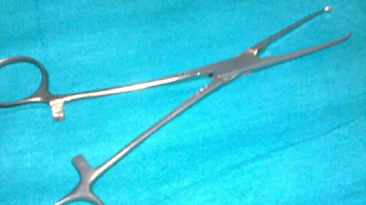 Un forceps chirurgical, uitat sase luni in abdomen, a iesit prin buricul unei femei din Franta