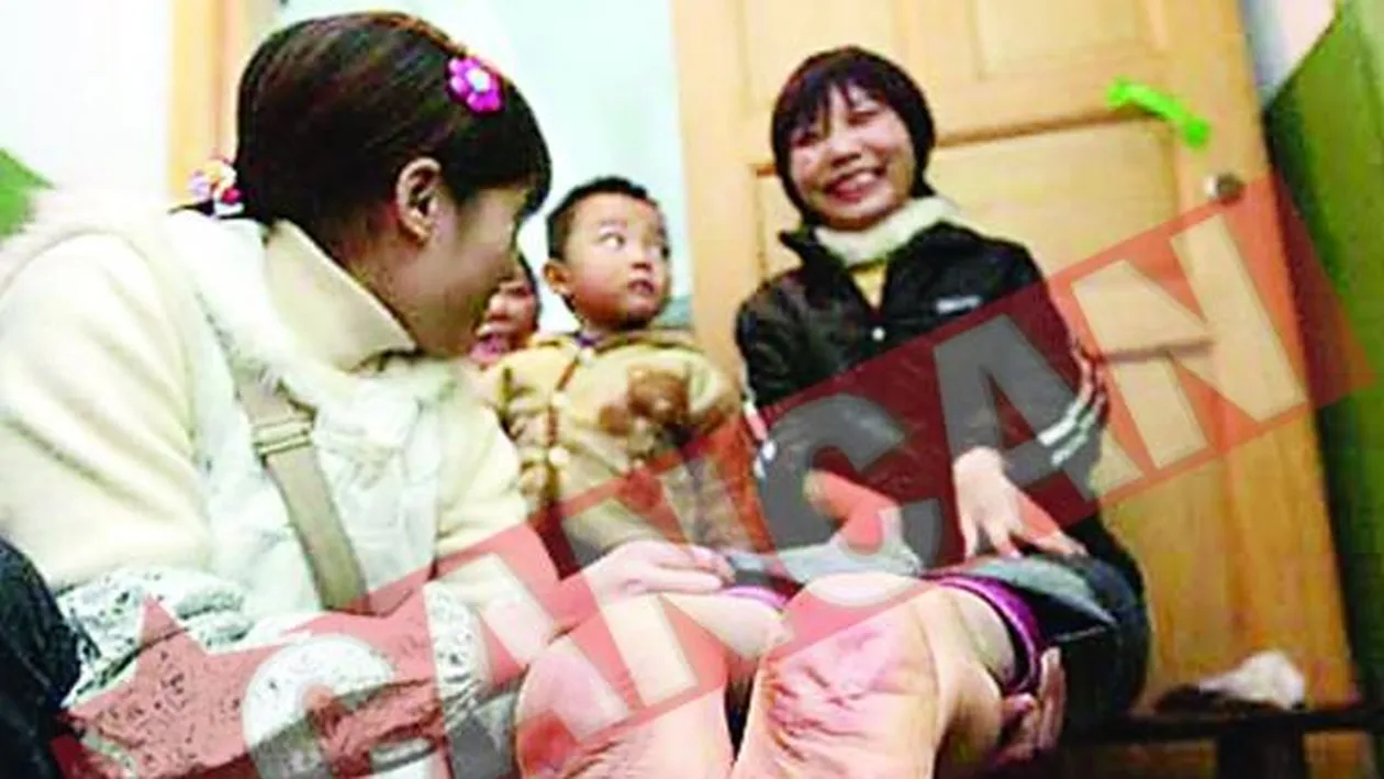 S-a nascut cu picioarele pe dos