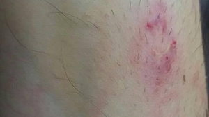 Un poliţist doljean aflat în misiune a fost muşcat de un fost deţinut