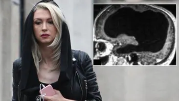 Andreea Bălan, complicații după stop-cardiac. A fost creierul afectat?! Am făcut două RMN-uri