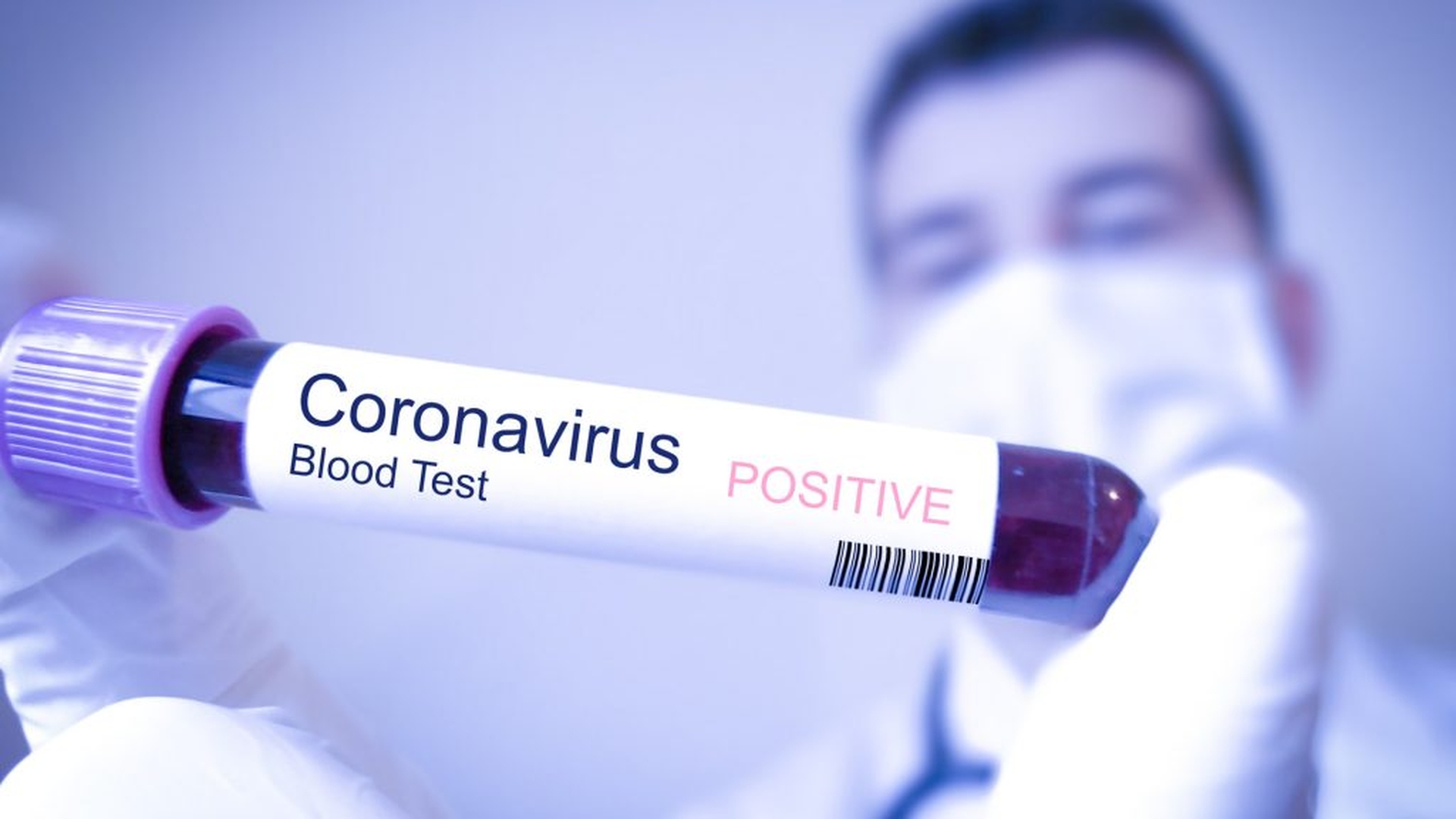 Teoria cercetătorilor de la Oxford care dă speranță planetei. Cine sunt oamenii care nu se pot infecta cu noul coronavirus