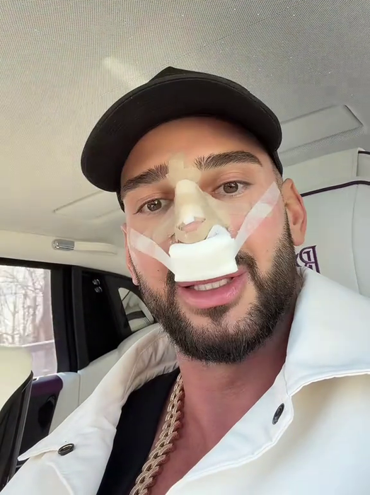 Dorian Popa, la un pas să îi „cadă nasul ca lui Michael Jackson”! Ce i-a descoperit medicul la operație? „Habar nu aveam”