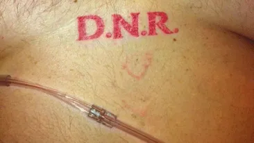 Un bărbat a ajuns în stare gravă la spital, iar medicii au rămas şocaţi după ce au văzut ce tatuaj avea pe piept