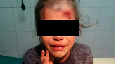 O fetiță din Călărași a ajuns la spital cu capul spart, după ce patroana unui magazin ar fi lovit-o cu un borcan de bulion