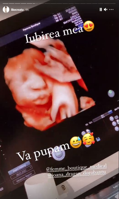 Like Creața de la Chefi la Cuțite a dezvăluit când naște: “Vine pe lume mai devreme, dar tot în termen” + primele ecografii cu fetița