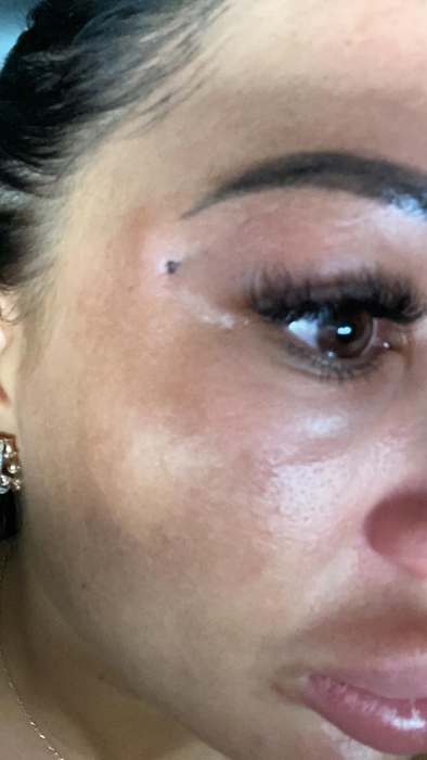 Simona Florentina, la câteva zile după intervenția chirurgicală