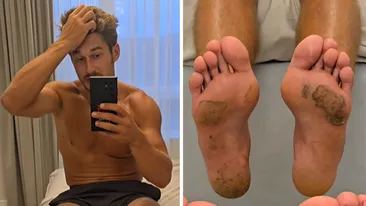 Cum arată tălpile concurenților de la Survivor, după ce au stat desculți 4 luni în jungla dominicană. Întors în România, Alberto Hangan a făcut publice imaginile