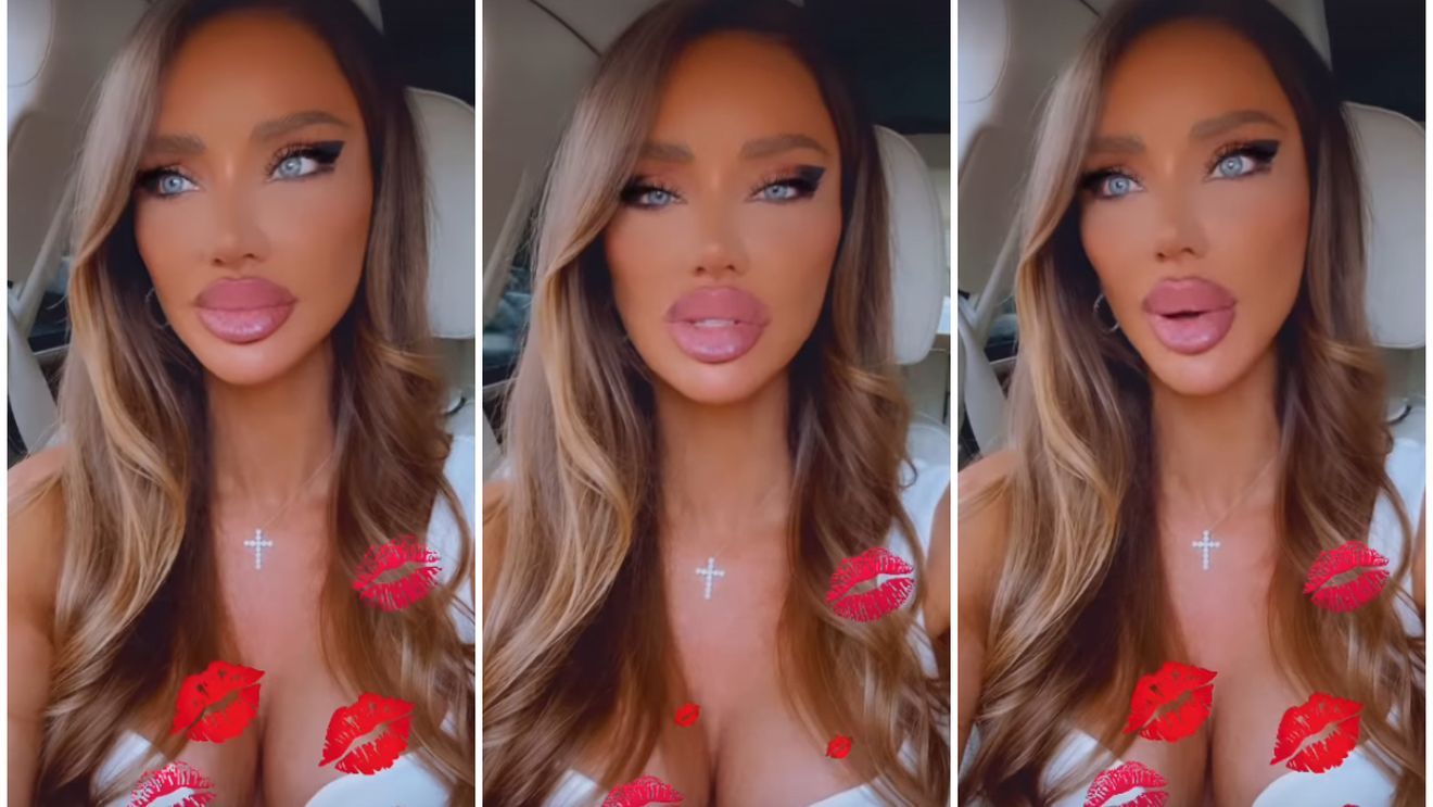 Bianca Drăgușanu, pusă la zid din cauza buzelor prea mari. Reacția neașteptată a vedetei: ”De asta mi-am făcut atâtea operații estetice”