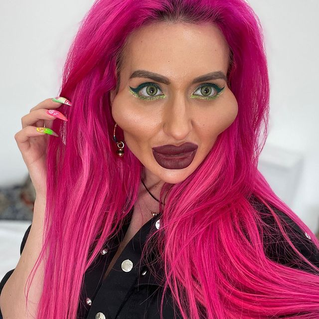 Cum a ajuns să arate o femeie dependentă de botox! Doctorii i-au spus să se oprească
