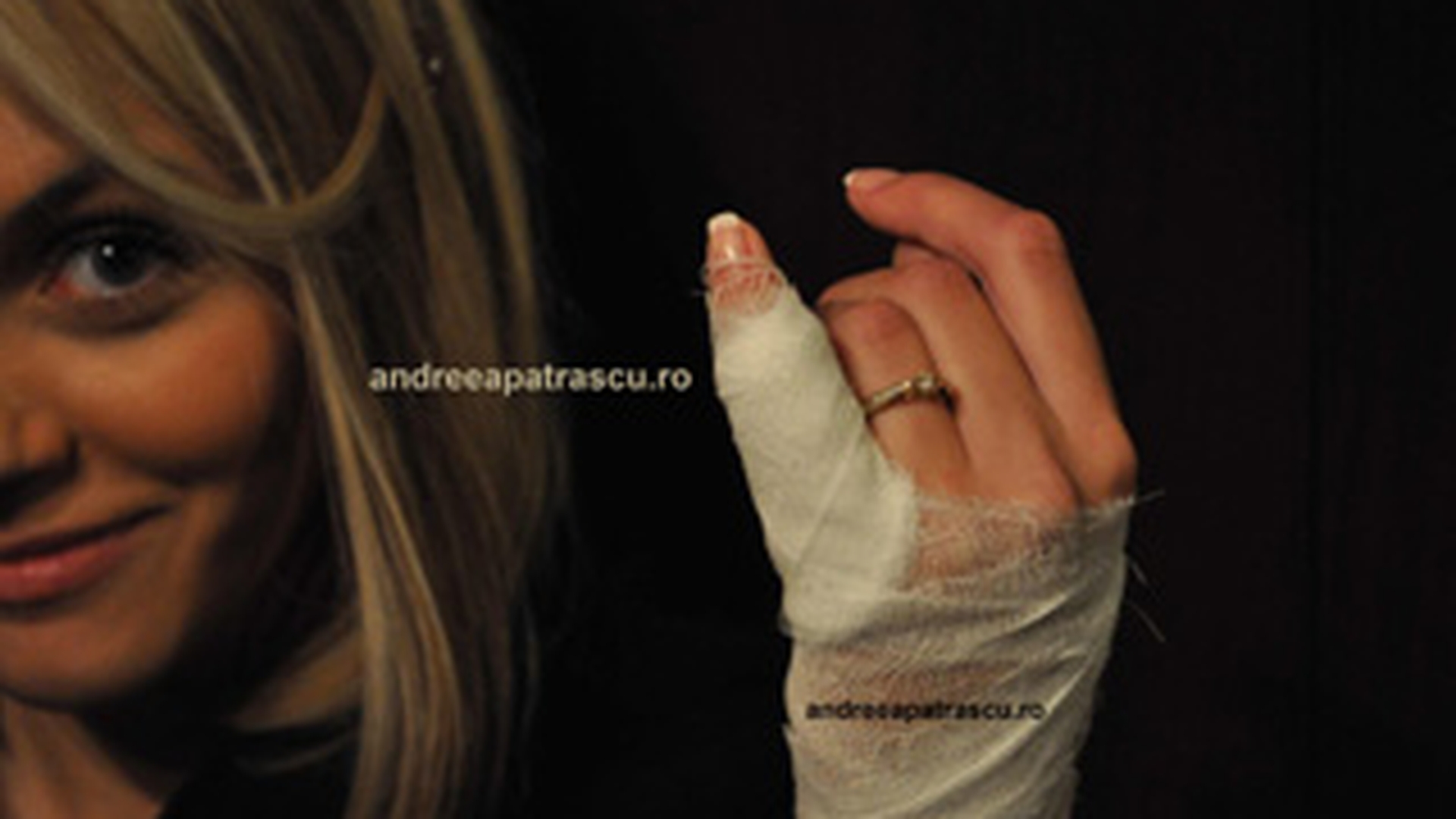 Andreea Patrascu a ajuns la Urgenta! S-a taiat la mana cand gatea!