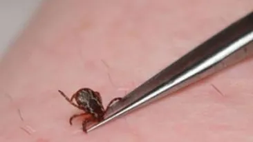 Ca la noi, la nimeni! Spitalele din tara au introdus taxa pe capuse. Vezi cat vei plati daca vei avea ghinionul de a fi muscat