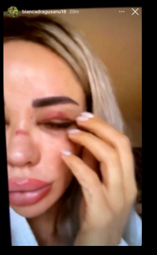 Bianca Drăgușanu snopită în bătaie de Alex Bodi
