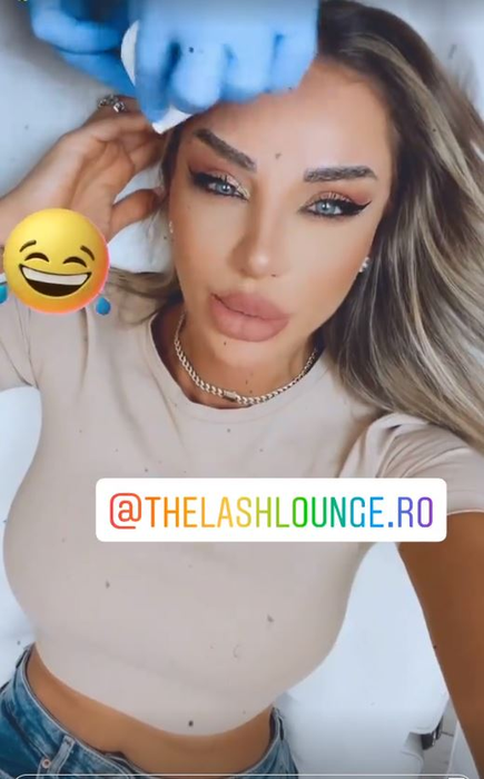 Bianca Drăgușanu, problemă delicată după o intervenție estetică: “Ce mi-o fi trebuit mie implant de sprâncene? O porcărie”