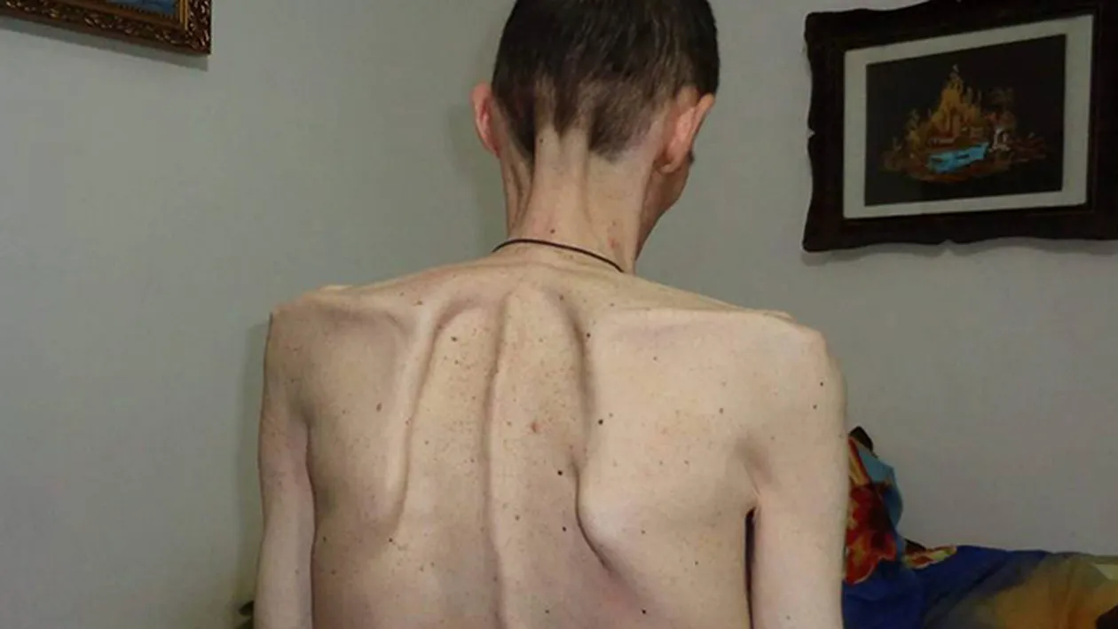 Un iesean a ajuns sa cantareasca cat un copil de 7 ani! Barbatul nu a mai mancat de trei ani