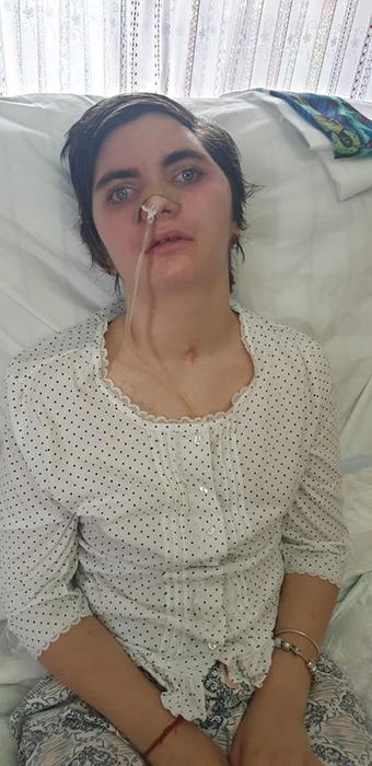 Ana Hopp are 14 ani și a ajuns în stare vegetativă în urma unui accident. Apelul cutremurător făcut de părinți la dorința ei! Orice sumă de bani e binevenită
