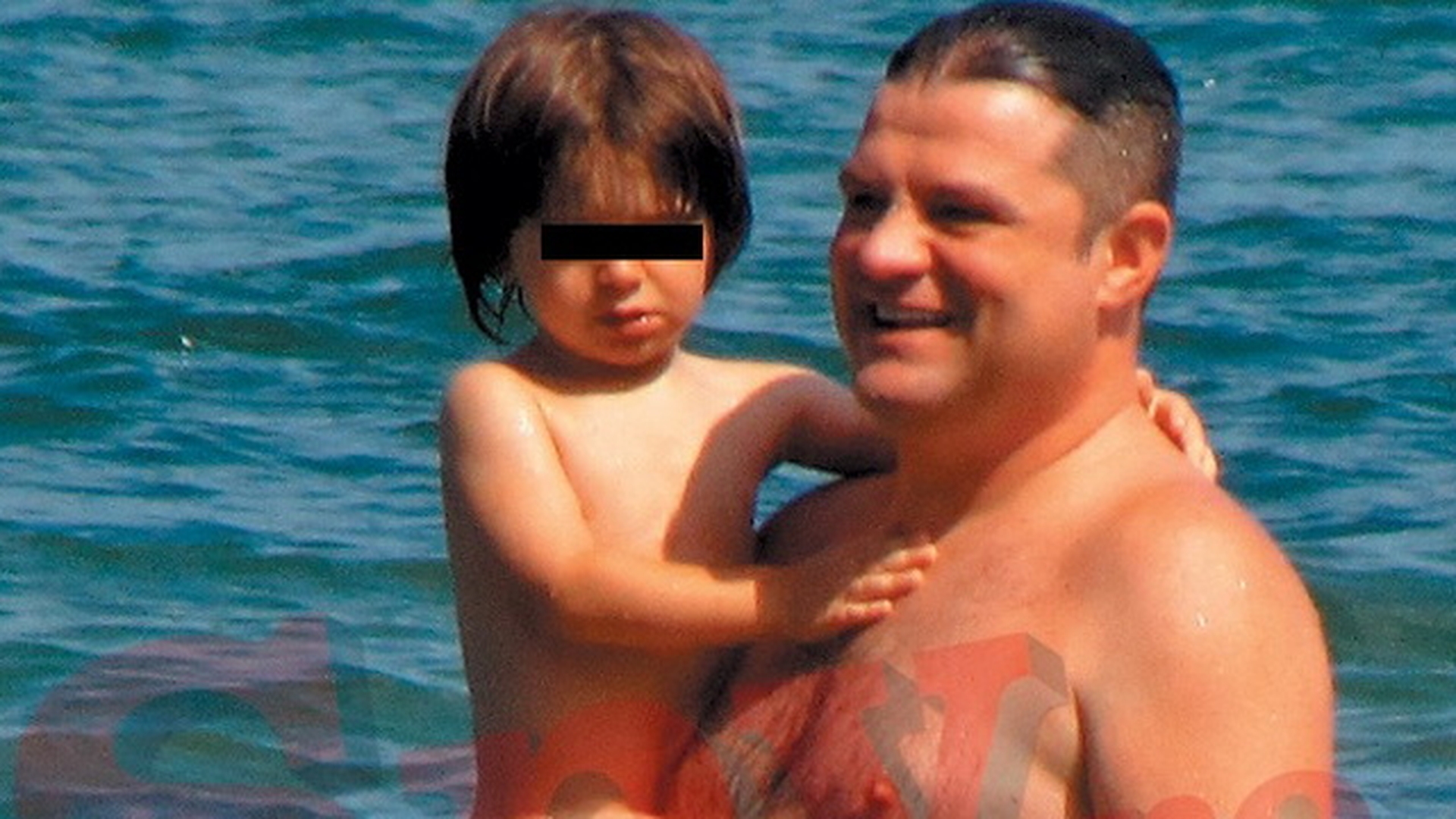 Unde dai si unde crapa! Duban si-a facut transplant de par in cap, dar i-a crescut pe…
