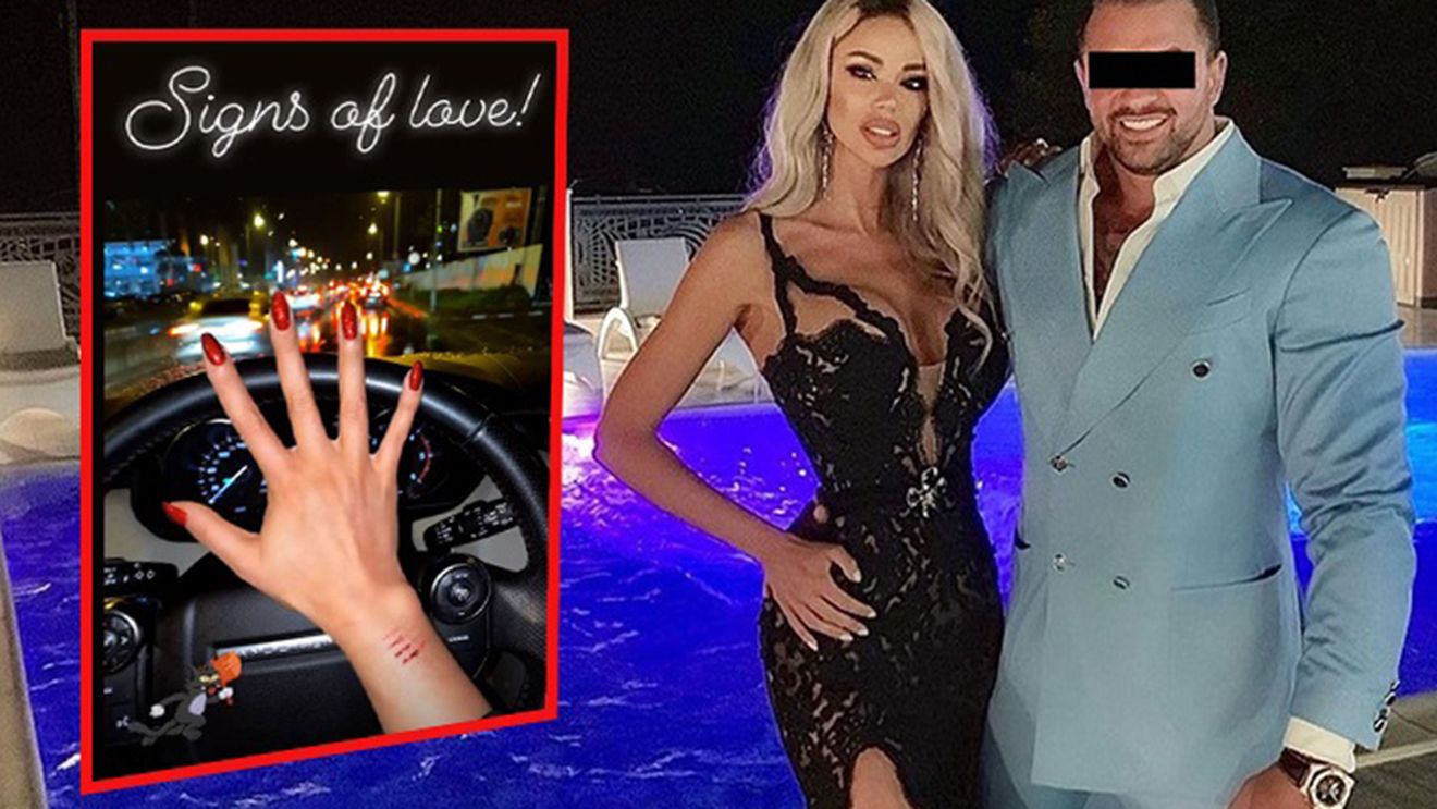 I-a înfipt furculița în mână când a aflat de divorț! Bianca Drăgușanu a ajuns la Urgențe după ce a fost agresată de soț: "A avut o coastă fisurată"