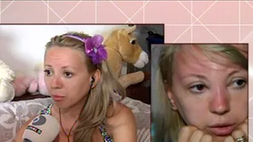 Atentie cat va expuneti la plaja! Larisa Dragulescu, tumefiata din cauza soarelui!