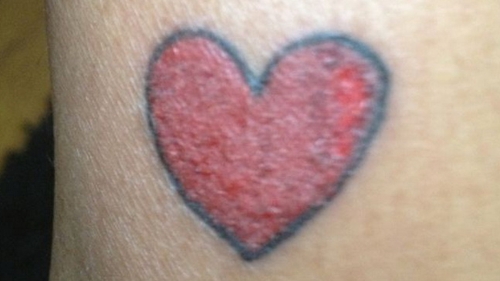 IMAGINI SOCANTE! Si-a facut un banal tatuaj, in forma de INIMA. Ce s-a intampla dupa cateva saptamani este INGROZITOR!