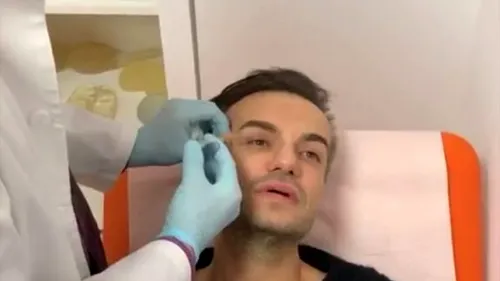 Răzvan Ciobanu și-a făcut o operație estetică extrem de dureroasă! ”M-am tăvălit pe jos de frică”