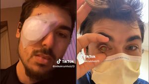 Ireal! Viața unui tânăr s-a schimbat radical după ce a ațipit cu lentile de contact în ochi. Diagnosticul medicilor a fost crunt