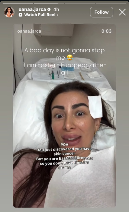 Oana Jarca suferă de o formă de cancer de piele/ sursă foto: Instagram