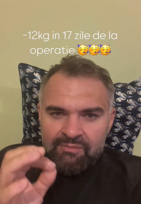 Darius Ursa și-a făcut operație de micșorare a stomacului. Sursă foto: Instagram darius_ursa