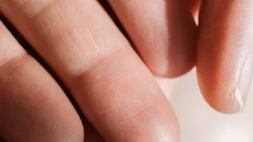 Știați că gemenii identici nu au aceleași amprente? Află aici cauzele