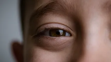 Dr. Mihai Craiu, semnal de alarmă pentru părinți: „Doza nocivă” care le distruge vederea copiilor