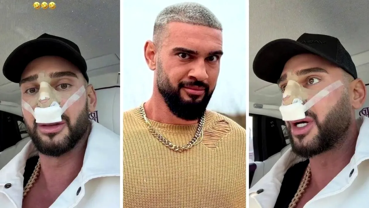 Ce problemă are Dorian Popa după operație. Prin ce trece: „Nu știu ce mi-a pus doctorul în nas”