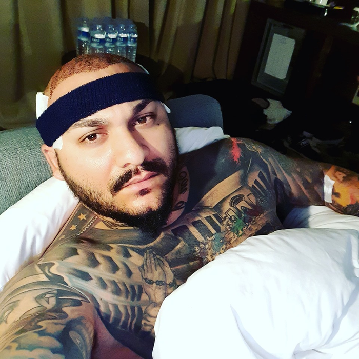 Cum arată Dani Mocanu după ce a făcut implant de păr la o clinică din Turcia!