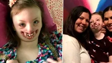 Sophia, fetița desfigurată de boala Rett și pe care unii „internauți” au batjocorit-o, a murit la vârsta de 10 ani