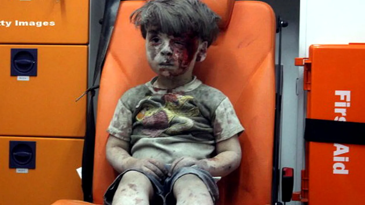 Cum arată acum Omran, copilul devenit un simbol al suferinţelor din Siria!