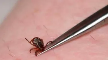 Ca la noi, la nimeni! Spitalele din tara au introdus taxa pe capuse. Vezi cat vei plati daca vei avea ghinionul de a fi muscat