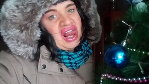 Cristi din Banat, ”torturat” de medicul estetician. ”Doar supă pot suge...”