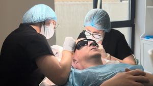 (P) Transplantul de păr și procedurile estetice la bărbați