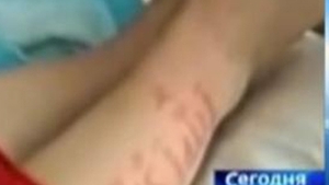 VIDEO Pe pielea unui bebelus de un an apar pasaje din Coran