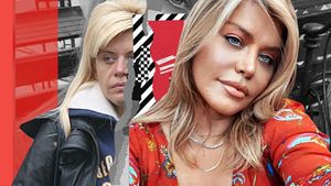 Imaginile pe care Loredana Groza le vrea șterse! Cum arăta artista înainte să fie acuzată că a trecut pe la estetician!