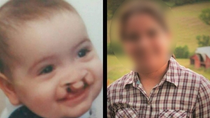 Povestea fetiţei născute în România cu o malformaţie gravă, lăsată în spital şi tratată de familia adoptivă din America! Cum arată azi fata, la 17 ani